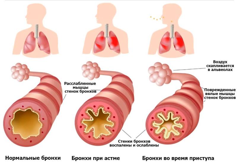 Диагностика асфиксии - 2
