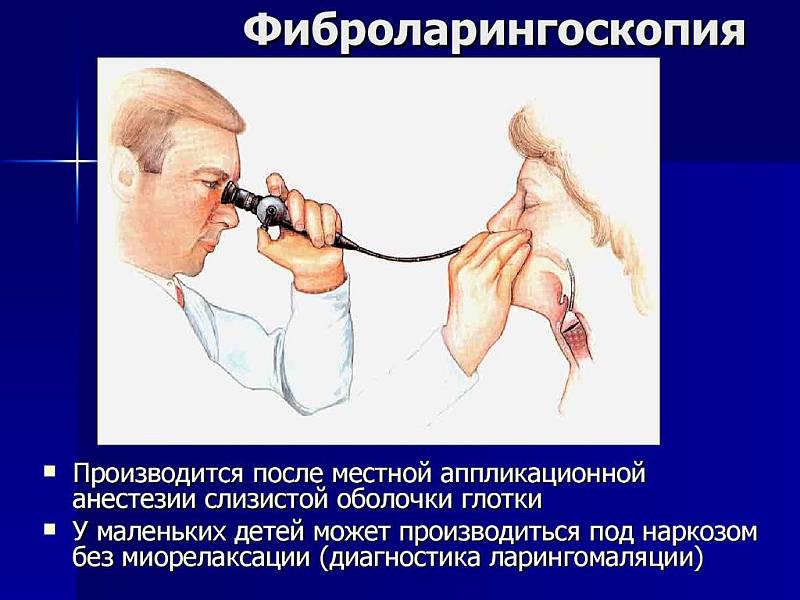 Фиброларингоскопия - метод диагностики трахеита - 3