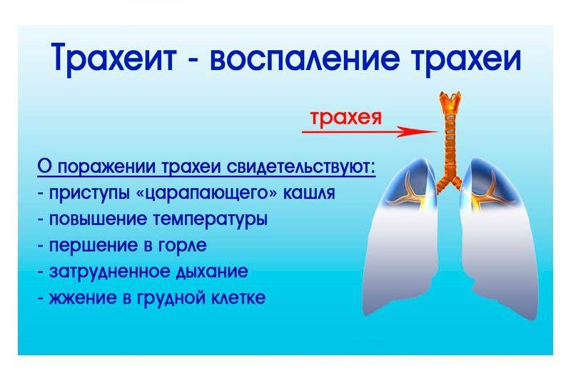 Характерные симптомы развития острого трахеита - 2