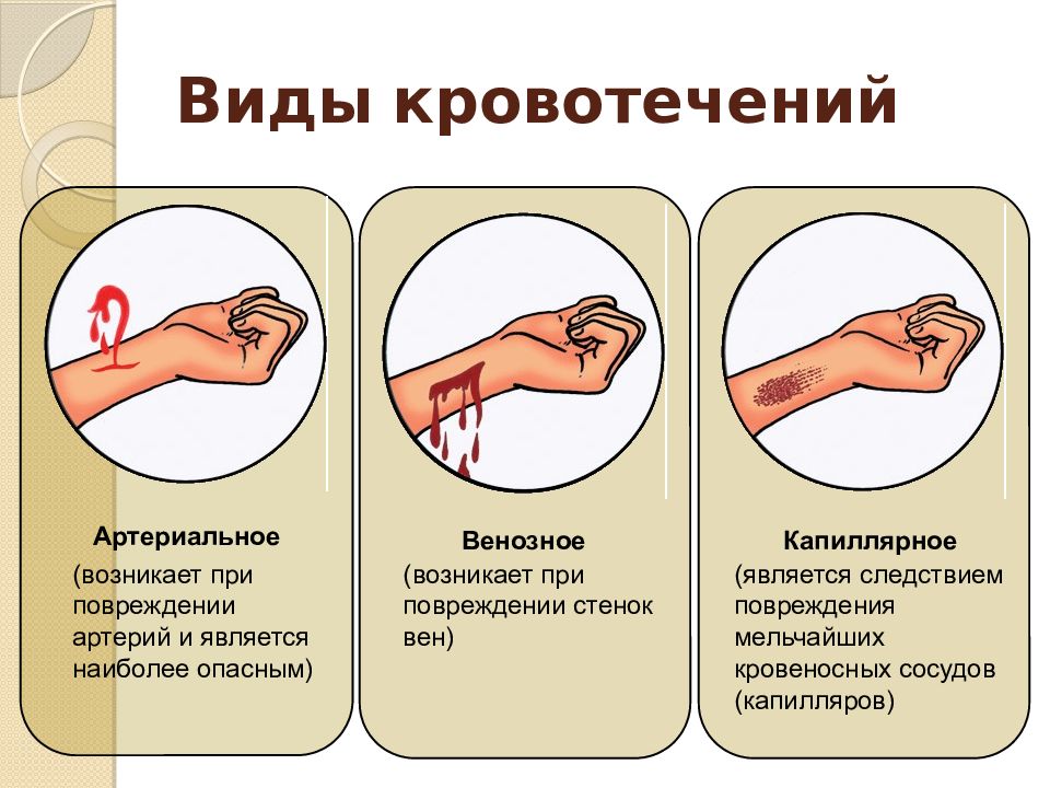 Как оказать первую помощь при кровотечениях?