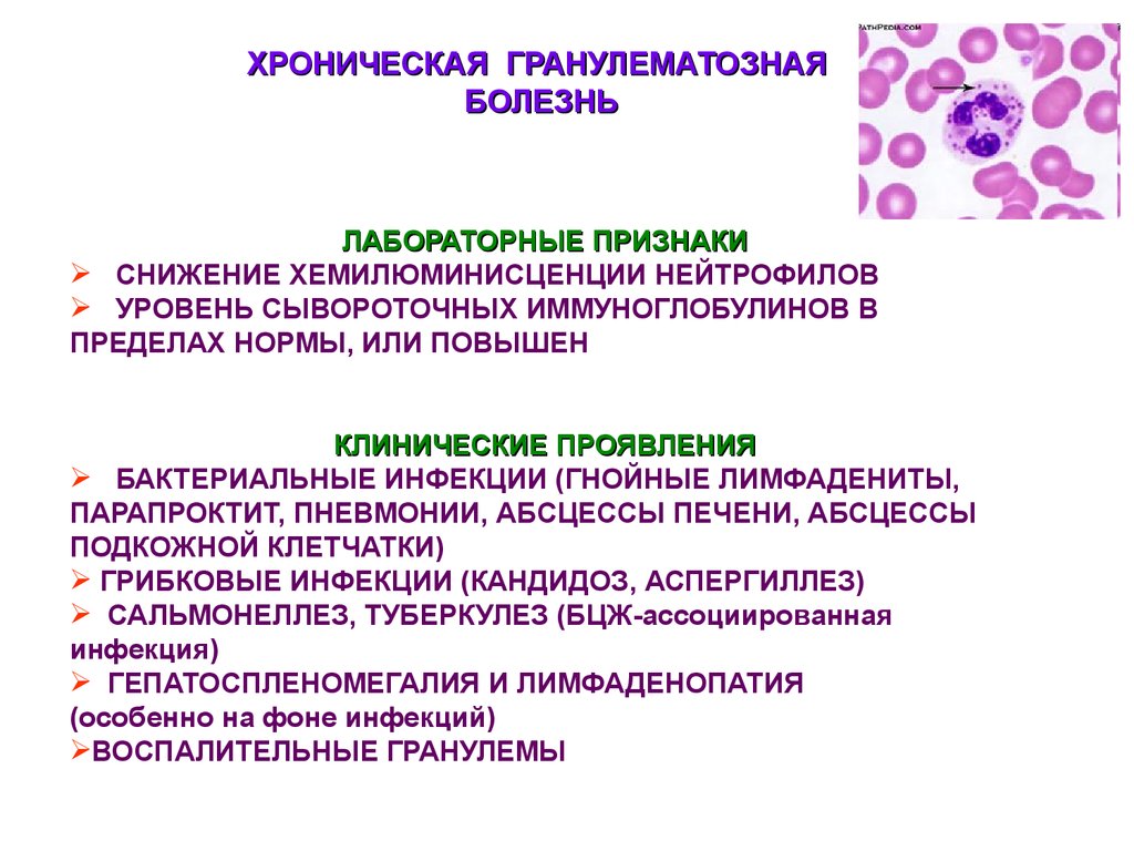 Хроническая грануляматозная болезнь - 2