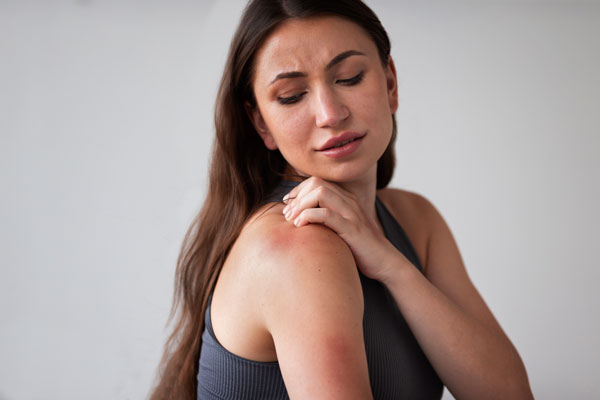 Лучшие мази от ожогов - 4