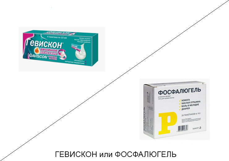 Что лучше Гевискон или Фосфалюгель?