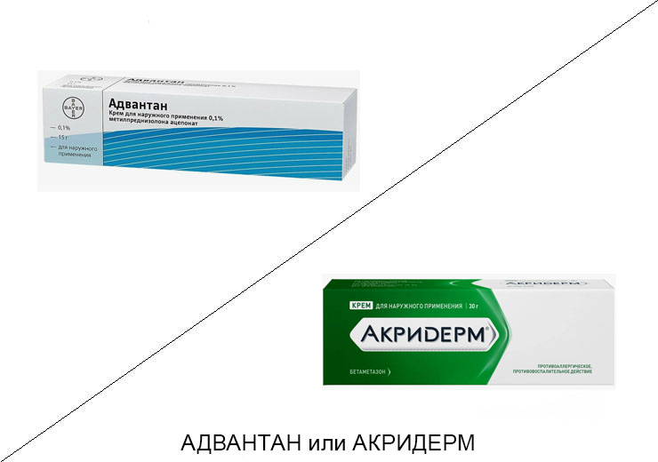 Что лучше Адвантан или Акридерм?