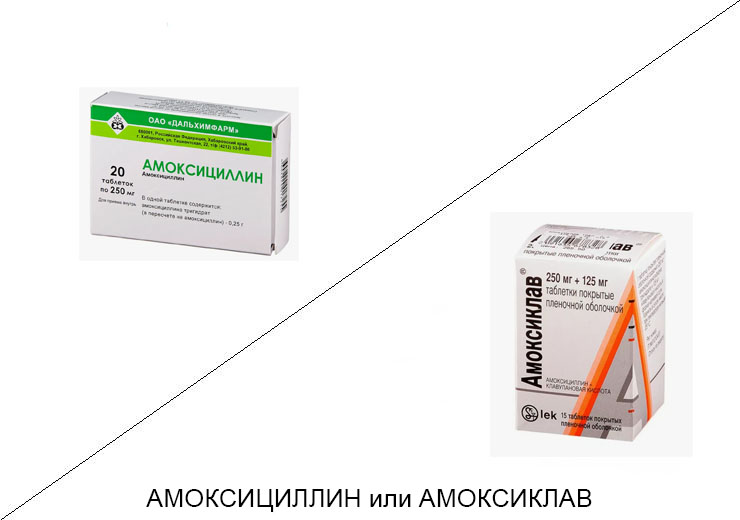 Амоксициллин или Амоксиклав: что лучше и в чём разница