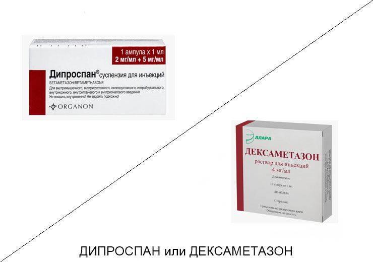 Дипроспан или Дексаметазон: что лучше и в чём разница Дипроспан или Дексаметазон: что лучше и в чём разница