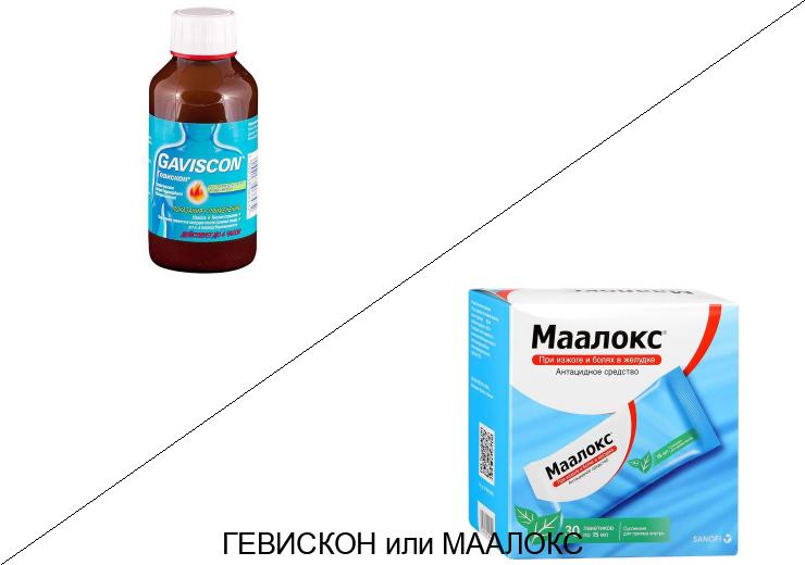 Гевискон или Маалокс: что лучше и в чём разница