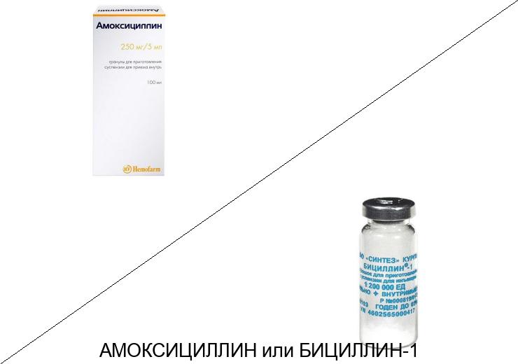 Бициллин или Амоксициллин: что лучше и в чём разница