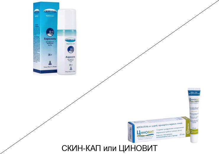 Циновит или Скин-кап: что лучше и в чём разница