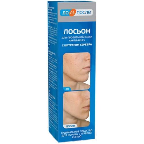 ДО И ПОСЛЕ ЛОСЬОН ДЛЯ ПРОБЛЕМНОЙ АНТИ-АКНЕ ЛОСЬОН ДЛЯ ЛИЦА 200 МЛ №1