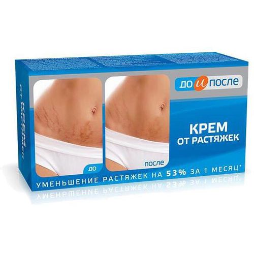 ДО И ПОСЛЕ КРЕМ ОТ РАСТЯЖЕК КОСМЕТИЧЕСКИЙ КРЕМ 100 МЛ №1