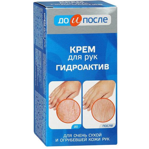 ДО И ПОСЛЕ КРЕМ Д/РУК ГИДРОАКТИВ КРЕМ ДЛЯ РУК 100 МЛ №1