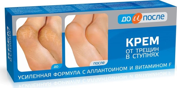 ДО И ПОСЛЕ КРЕМ Д/НОГ ОТ ТРЕЩИН В СТУПНЯХ КРЕМ ДЛЯ НОГ 50 МЛ №1