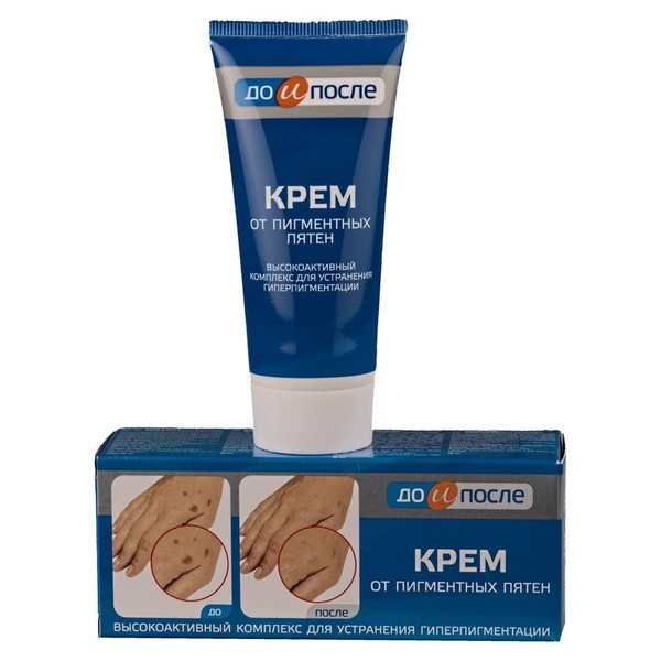 ДО И ПОСЛЕ КРЕМ ОТ ПИГМЕНТНЫХ ПЯТЕН КРЕМ ДЛЯ ЛИЦА 50 МЛ №1